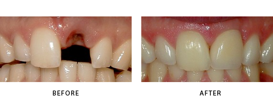 Emergency Dentist Stamford