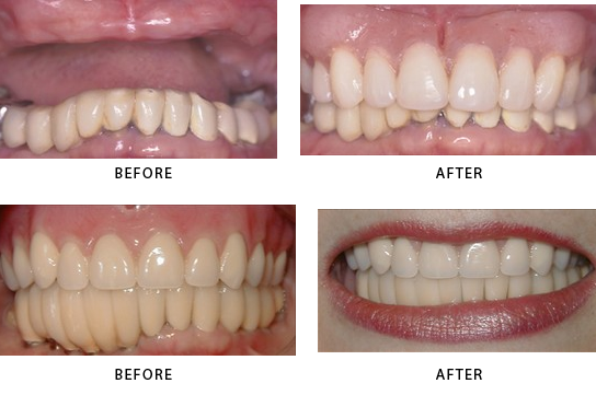 Stamford Cosmetic Dentist