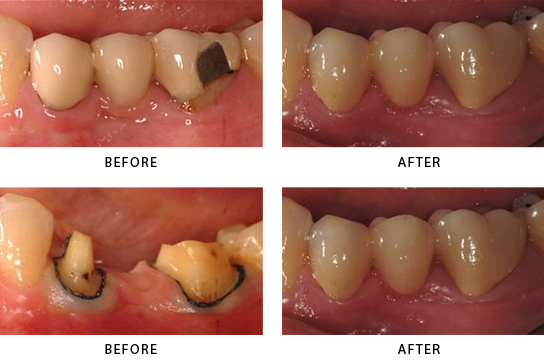 Family Dentist in Stamford