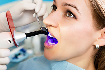 All About You Dental Group | Teeth Whitening, Dental Fillings and Fluoride Treatment