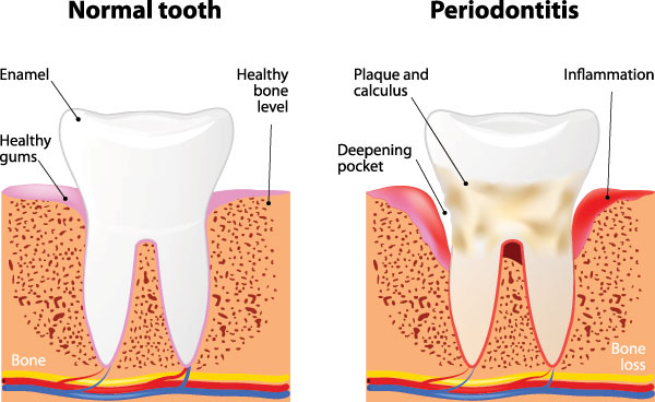 All About You Dental Group | Teeth Whitening, Emergency Treatment and Cosmetic Dentistry