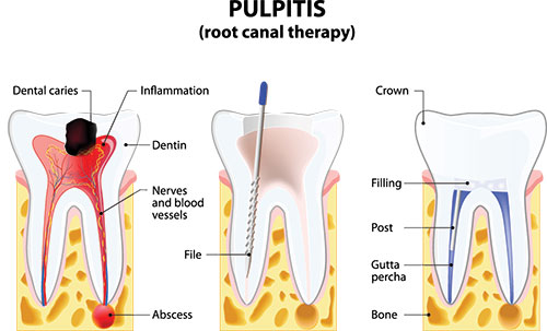 All About You Dental Group | Dentures, Periodontal Treatment and Oral Exams