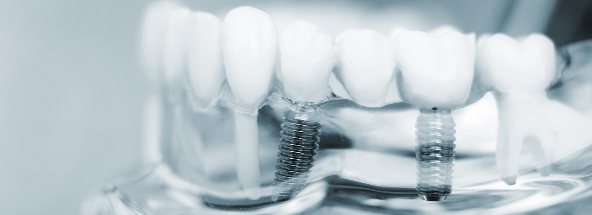 All About You Dental Group | Oral Cancer Screening, Cosmetic Dentistry and Root Canals